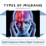 Types of migraines: Understanding your specific type is key to finding relief. Learn symptoms, treatments, and prevention strategies that work.