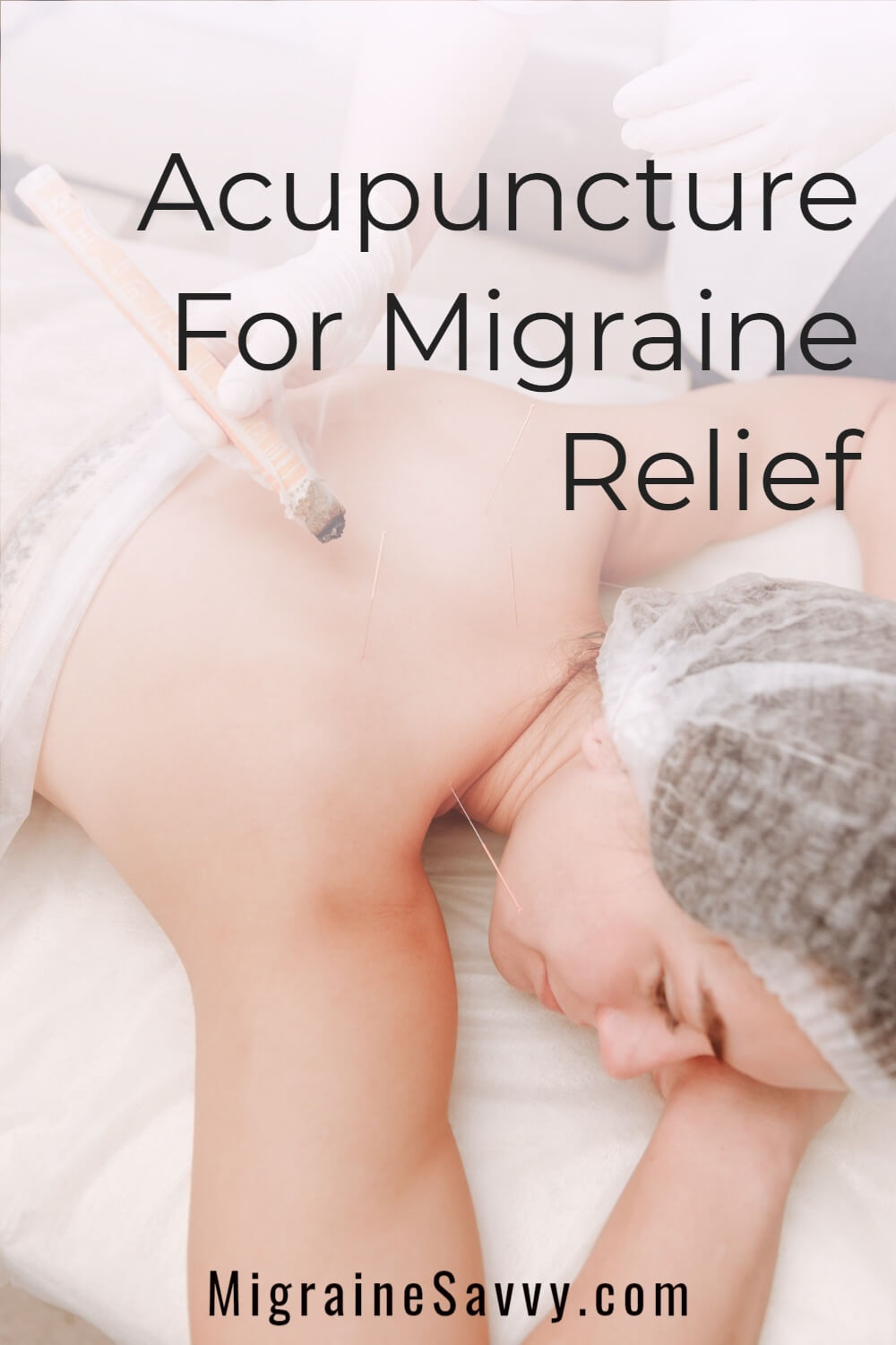 Acupuncture for Migraine Pinterest 2021