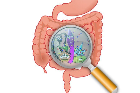 Can parasites be the cause of your migraine headache? Come find out. This article covers this thoroughly.
