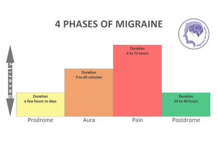 Complex Migraine attacks have 4 phases: aura, prodrome, pain, and postdrome.