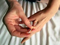 Alternative Treatment for Migraines Acupuncture C4 @migrainesavvy