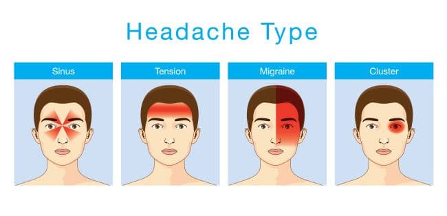 Here are 4 different types of headaches, from sinus to cluster, each have unique symptoms and causes.