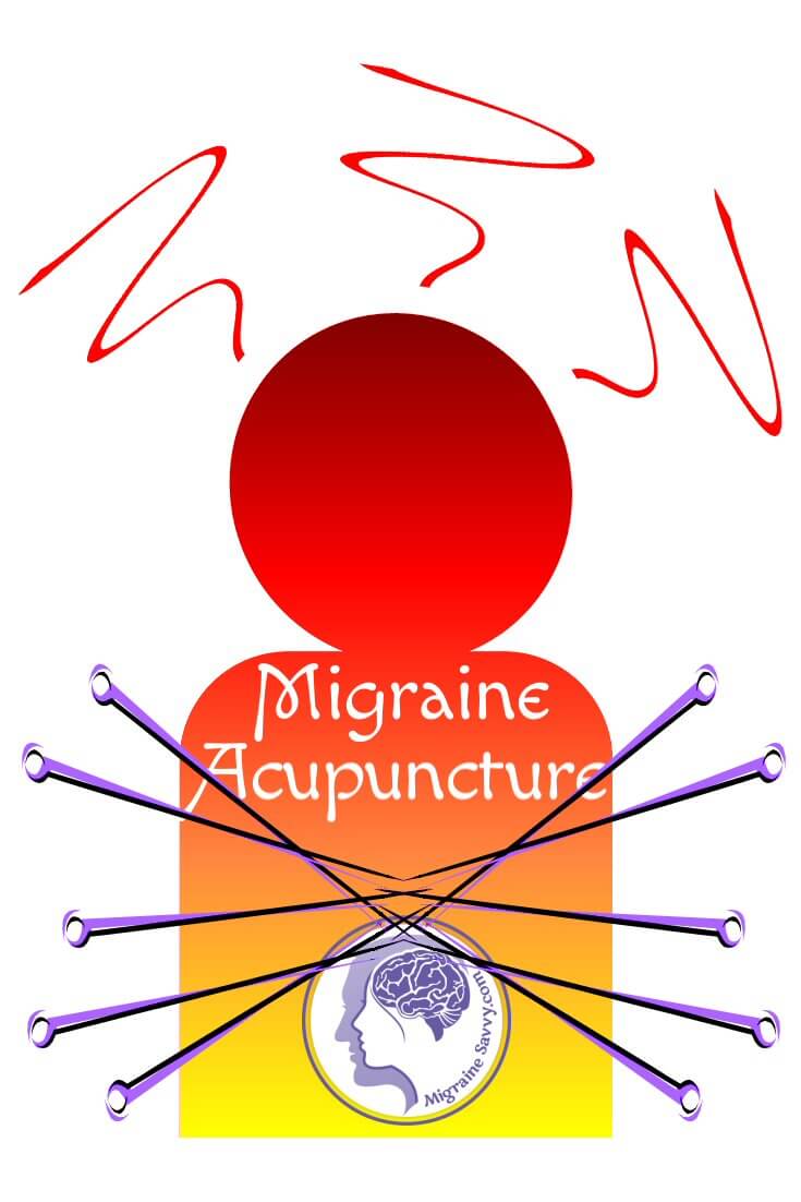 Can Acupuncture for Migraines Stop Relentless Attacks?