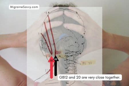 You can see GB 12 and GB20 pressure point locations on this meridian overlay